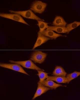 Immunocytochemistry/Immunofluorescence: ATP6V0A1 Antibody [NBP2-92219] - Immunofluorescence analysis of NIH/3T3 cells using ATP6V0A1 antibody (NBP2-92219) at dilution of 1:100. Blue: DAPI for nuclear staining.