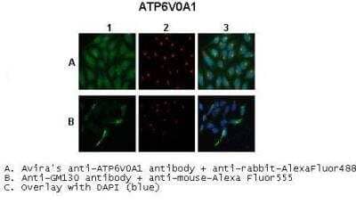 Immunocytochemistry/Immunofluorescence: ATP6V0A1 Antibody [NBP2-87054] - Sample Type: A. untransfected HeLa cells B. mATP6V0A1 transfected HeLa cells. Primary Antibody Dilution: 1:250. Secondary Antibody: Anti-rabbit AlexaFluor 488. Secondary Antibody Dilution: 1:1000. Color/Signal Descriptions: Atp6v0a1: Green DAPI:Blue. Gene Name: Atp6v0a1 . Submitted by: Anonymous