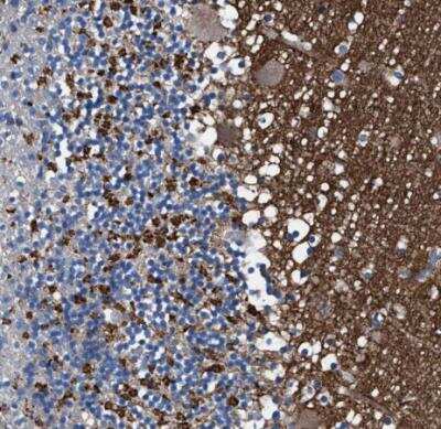 Immunohistochemistry-Paraffin: ATP6V0A1 Antibody [NBP1-89342] - Staining of human cerebellum shows strong cytoplasmic postivity in cells in granular layer.