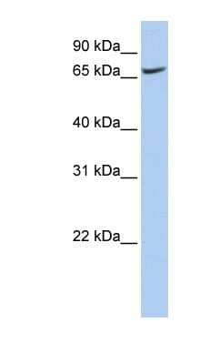 Western Blot: ATP6V0A1 Antibody [NBP1-59949] - Hela cell lysate, concentration 0.2-1 ug/ml.