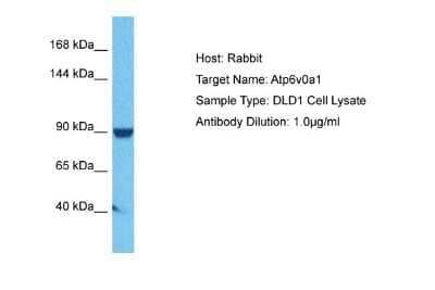 Western Blot: ATP6V0A1 Antibody [NBP2-87054] - Host: Rabbit. Target Name: Atp6v0a1. Sample Tissue: Human DLD1 Whole Cell. Antibody Dilution: 1ug/ml