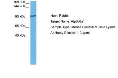 Western Blot: ATP6V0A1 Antibody [NBP2-87054] - Host: Rabbit. Target Name: Atp6v0a1. Sample Tissue: Mouse Mouse Skeletal Muscle. Antibody Dilution: 1ug/ml