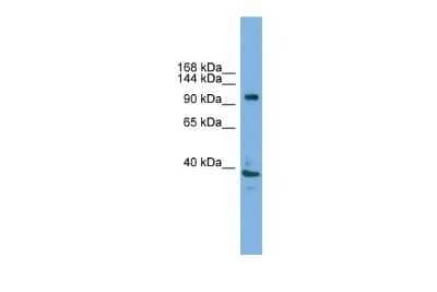 Western Blot: ATP6V0A1 Antibody [NBP2-87054] - WB Suggested Anti-Atp6v0a1 Antibody Titration: 0.2-1 ug/ml. Positive Control: Mouse Uterus