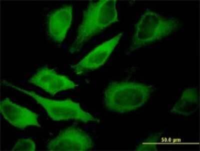 Immunocytochemistry/Immunofluorescence: ATP6V1A Antibody (4F5) [H00000523-M02] - Analysis of monoclonal antibody to ATP6V1A on HeLa cell . Antibody concentration 10 ug/ml.