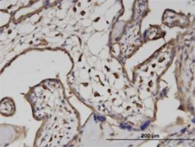 Immunohistochemistry-Paraffin: ATP6V1A Antibody (4F5) [H00000523-M02] - Analysis of monoclonal antibody to ATP6V1A on formalin-fixed paraffin-embedded human placenta. Antibody concentration 3 ug/ml.