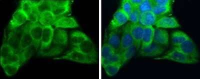 <b>Genetic Strategies Validation. </b>Immunocytochemistry/Immunofluorescence: ATP6V1A Antibody (GT811) [NBP3-13541] - ATP6V1A antibody [GT811] detects ATP6V1A protein at cytoplasm by immunofluorescent analysis. Sample: Hep G2 cells were fixed in 4% paraformaldehyde at RT for 15 min. Green: ATP6V1A protein stained by ATP6V1A antibody [GT811] (NBP3-13541) diluted at 1:200. Blue: Hoechst 33342 staining.