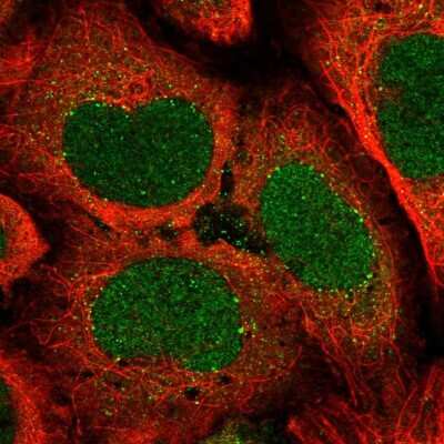 Immunocytochemistry/Immunofluorescence: ATP6V1A Antibody [NBP2-55164] - Staining of human cell line U-2 OS shows localization to nucleus, cytosol & vesicles.