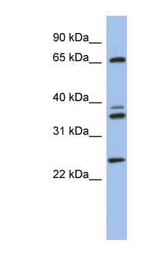 Western Blot: ATP6V1A Antibody [NBP1-55212] - Human Brain lysate, concentration 0.2-1 ug/ml.