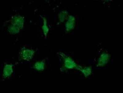 Immunocytochemistry/Immunofluorescence: ATP6V1B1 Antibody (OTI1H6) - Azide and BSA Free [NBP2-70237] - Staining of COS7 cells transiently transfected by pCMV6-ENTRY ATP6V1B1.