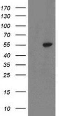 Western Blot: ATP6V1B1 Antibody (OTI1H6) - Azide and BSA Free [NBP2-70237] - HEK293T cells were transfected with the pCMV6-ENTRY control (Left lane) or pCMV6-ENTRY ATP6V1B1 (Right lane) cDNA for 48 hrs and lysed. Equivalent amounts of cell lysates (5 ug per lane) were separated by SDS-PAGE and immunoblotted with anti-ATP6V1B1.