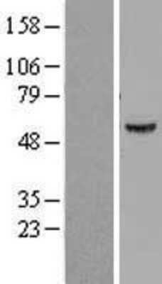 Western Blot: ATP6V1B1 Overexpression Lysate (Adult Normal) [NBL1-07838] Left-Empty vector transfected control cell lysate (HEK293 cell lysate); Right -Over-expression Lysate for ATP6V1B1.