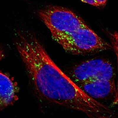 Immunocytochemistry/Immunofluorescence: ATP6V1B2 Antibody [NBP1-88890] - Immunofluorescent staining of human cell line U-2 OS shows localization to vesicles.