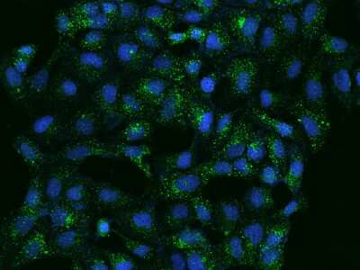 Immunocytochemistry/Immunofluorescence: ATP6V1B2 Antibody [NBP2-97188] - Immunofluorescence staining of ATP6V1B2 in U2OS cells. Cells were fixed with 4% PFA, permeabilzed with 0.1% Triton X-100 in PBS, blocked with 10% serum, and incubated with rabbit anti-Human ATP6V1B2 polyclonal antibody (dilution ratio 1:100) at 4C overnight. Then cells were stained with the Alexa Fluor(R)488-conjugated Goat Anti-rabbit IgG secondary antibody (green) and counterstained with DAPI (blue).Positive staining was localized to Cytoplasm.