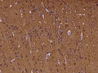 Immunohistochemistry-Paraffin: ATP6V1B2 Antibody [NBP2-97188] - Immunochemical staining of human ATP6V1B2 in human kidney with rabbit polyclonal antibody at 1:100 dilution, formalin-fixed paraffin embedded sections.