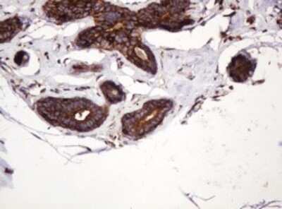 Immunohistochemistry: ATP6V1B2 Antibody (OTI1E11) - Azide and BSA Free [NBP2-70238] - Analysis of Human breast tissue. (Heat-induced epitope retrieval by 10mM citric buffer, pH6.0, 120C for 3min)