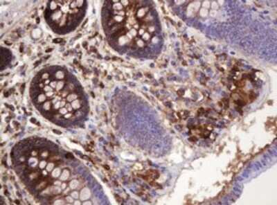 Immunohistochemistry: ATP6V1B2 Antibody (OTI1E11) - Azide and BSA Free [NBP2-70238] - Analysis of Human colon tissue. (Heat-induced epitope retrieval by 10mM citric buffer, pH6.0, 120C for 3min)