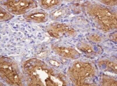 Immunohistochemistry: ATP6V1B2 Antibody (OTI1E11) - Azide and BSA Free [NBP2-70238] - Analysis of Human Kidney tissue. (Heat-induced epitope retrieval by 10mM citric buffer, pH6.0, 120C for 3min)