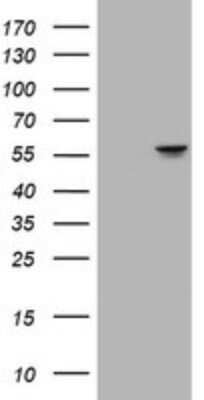 Western Blot: ATP6V1B2 Antibody (OTI1E11) - Azide and BSA Free [NBP2-70238] - Analysis of HEK293T cells were transfected with the pCMV6-ENTRY control (Left lane) or pCMV6-ENTRY ATP6V1B2.