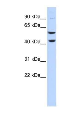 Western Blot: ATP6V1B2 Antibody [NBP1-54858] - Titration: 0.2-1 ug/ml, Positive Control: Hela cell lysate.