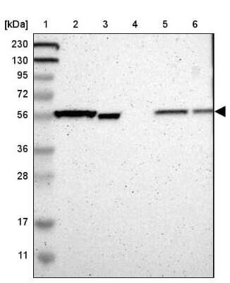 Western Blot: ATP6V1B2 Antibody [NBP1-88890] - Lane 1: Marker  [kDa] 230, 130, 95, 72, 56, 36, 28, 17, 11.  Lane 2: Human cell line RT-4.  Lane 3: Human cell line U-251MG sp.  Lane 4: Human plasma (IgG/HSA depleted).  Lane 5: Human liver tissue.  Lane 6: Human tonsil tissue