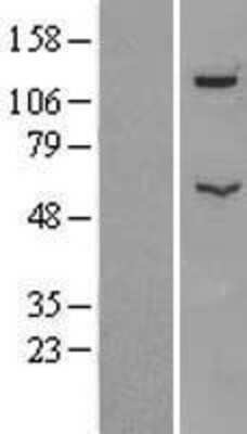 Western Blot: ATP6V1B2 Overexpression Lysate (Adult Normal) [NBL1-07839] Left-Empty vector transfected control cell lysate (HEK293 cell lysate); Right -Over-expression Lysate for ATP6V1B2.