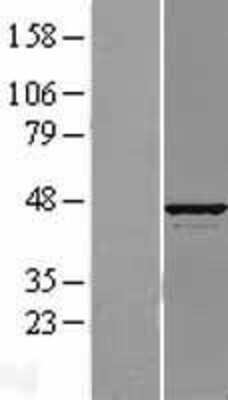 Western Blot: ATP6V1C1 Overexpression Lysate (Adult Normal) [NBL1-07840] Left-Empty vector transfected control cell lysate (HEK293 cell lysate); Right -Over-expression Lysate for ATP6V1C1.