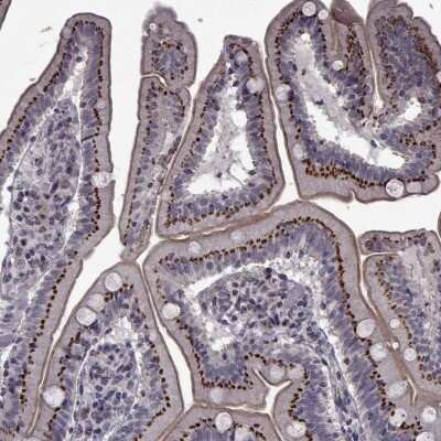 Immunocytochemistry/Immunofluorescence: ATP6V1C2 Antibody [NBP2-68854] - Immunohistochemical staining of human small intestine shows strong cytoplasmic positivity in glandular cells.