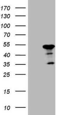 Western Blot: ATP6V1C2 Antibody (OTI8H4) - Azide and BSA Free [NBP2-72465] - Analysis of HEK293T cells were transfected with the pCMV6-ENTRY control (Left lane) or pCMV6-ENTRY ATP6V1C2.