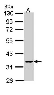 Western Blot: ATP6V1C2 Antibody [NBP1-33020] - Sample (30 ug of whole cell lysate) A: Molt-4 10% SDS PAGE; antibody diluted at 1:1000.