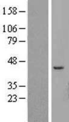 Western Blot: ATP6V1C2 Overexpression Lysate (Adult Normal) [NBL1-07841] Left-Empty vector transfected control cell lysate (HEK293 cell lysate); Right -Over-expression Lysate for ATP6V1C2.