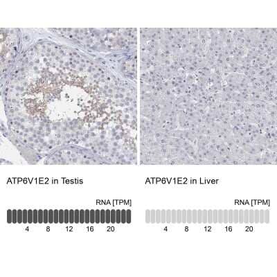 Immunocytochemistry/Immunofluorescence: ATP6V1E2 Antibody [NBP3-17046] - Analysis in human testis and liver tissues using Anti-ATP6V1E2 antibody. Corresponding ATP6V1E2 RNA-seq data are presented for the same tissues.