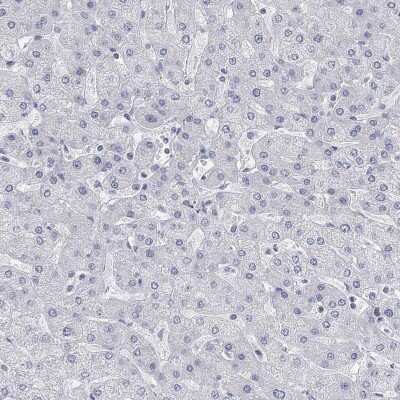 Immunohistochemistry-Paraffin: ATP6V1E2 Antibody [NBP3-17046] - Staining of human liver shows low expression as expected.