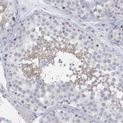 Immunohistochemistry-Paraffin: ATP6V1E2 Antibody [NBP3-17046] - Staining of human testis shows high expression.