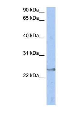 Western Blot: ATP6V1E2 Antibody [NBP1-54601] - Titration: 0.2-1 ug/ml, Positive Control: Human Spleen.