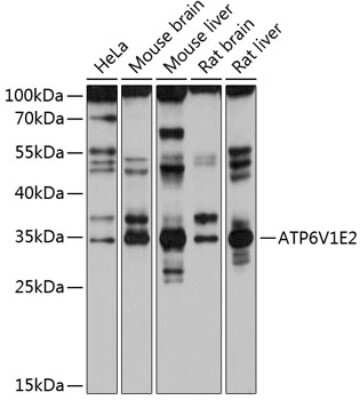 Western Blot: ATP6V1E2 Antibody [NBP2-92065] - Analysis of extracts of various cell lines, using ATP6V1E2 at 1:1000 dilution.Secondary antibody: HRP Goat Anti-Rabbit IgG (H+L) at 1:10000 dilution.Lysates/proteins: 25ug per lane.Blocking buffer: 3% nonfat dry milk in TBST.Detection: ECL Basic Kit .Exposure time: 60s.