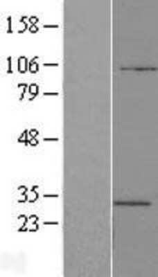 Western Blot: ATP6V1E2 Overexpression Lysate (Adult Normal) [NBL1-07844] Left-Empty vector transfected control cell lysate (HEK293 cell lysate); Right -Over-expression Lysate for ATP6V1E2.