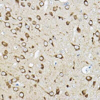 Immunohistochemistry-Paraffin: ATP6V1G2 Antibody [NBP3-15964] - Immunohistochemistry of paraffin-embedded rat brain using ATP6V1G2 Rabbit pAb (NBP3-15964) at dilution of 1:50 (40x lens).Perform high pressure antigen retrieval with 10 mM citrate buffer pH 6.0 before commencing with IHC staining protocol.