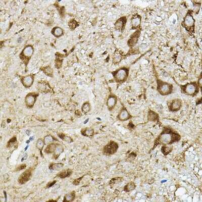 Immunohistochemistry-Paraffin: ATP6V1G2 Antibody [NBP3-15964] - Immunohistochemistry of paraffin-embedded mouse spinal cord using ATP6V1G2 Rabbit pAb (NBP3-15964) at dilution of 1:50 (40x lens).Perform high pressure antigen retrieval with 10 mM citrate buffer pH 6.0 before commencing with IHC staining protocol.