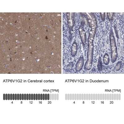 Immunohistochemistry-Paraffin: ATP6V1G2 Antibody [NBP3-17121] - Analysis in human cerebral cortex and duodenum tissues using Anti-ATP6V1G2 antibody. Corresponding ATP6V1G2 RNA-seq data are presented for the same tissues.