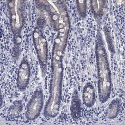 Immunohistochemistry-Paraffin: ATP6V1G2 Antibody [NBP3-17121] - Staining of human duodenum shows low expression as expected.