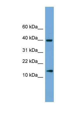 Western Blot: ATP6V1G2 Antibody [NBP1-79685] - Human Brain lysate, concentration 0.2-1 ug/ml.