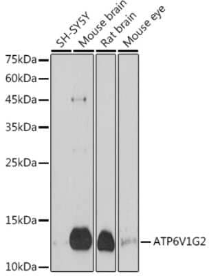 Western Blot: ATP6V1G2 Antibody [NBP3-15964] - Western blot analysis of extracts of various cell lines, using ATP6V1G2 antibody (NBP3-15964) at 1:1000 dilution. Secondary antibody: HRP Goat Anti-Rabbit IgG (H+L) at 1:10000 dilution. Lysates/proteins: 25ug per lane. Blocking buffer: 3% nonfat dry milk in TBST. Detection: ECL Basic Kit. Exposure time: 180s.