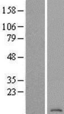 Western Blot: ATP6V1G2 Overexpression Lysate (Adult Normal) [NBP2-05681] Left-Empty vector transfected control cell lysate (HEK293 cell lysate); Right -Over-expression Lysate for ATP6V1G2.