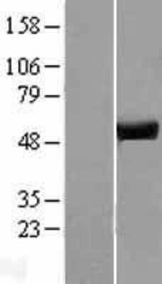 Western Blot: ATP6V1H Overexpression Lysate (Adult Normal) [NBP2-04470] Left-Empty vector transfected control cell lysate (HEK293 cell lysate); Right -Over-expression Lysate for ATP6V1H.