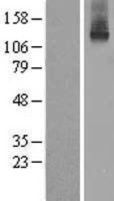 Western Blot: ATP7b Overexpression Lysate (Adult Normal) [NBL1-07848] Left-Empty vector transfected control cell lysate (HEK293 cell lysate); Right -Over-expression Lysate for ATP7b.