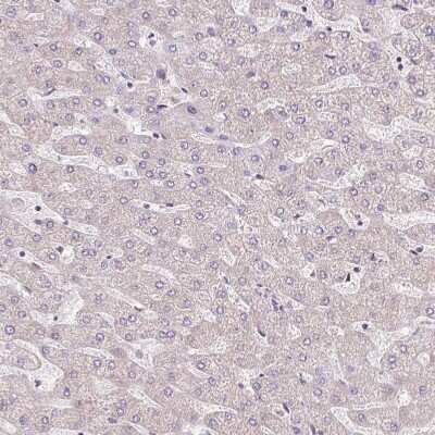 Immunohistochemistry-Paraffin: ATP8A1 Antibody [NBP2-30403] - Staining of human liver shows no positivity in hepatocytes as expected.