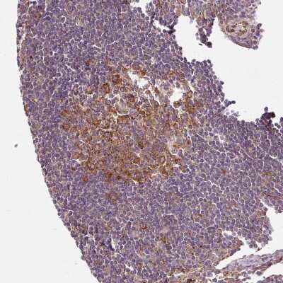 Immunohistochemistry-Paraffin: ATP8A1 Antibody [NBP2-30403] - Staining of human lymph node shows moderate membranous positivity in germinal center cells.