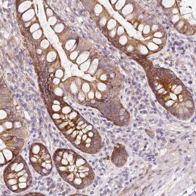 Immunohistochemistry-Paraffin: ATP8A1 Antibody [NBP2-30403] - Staining of human small intestine shows moderate membranous positivity in glandular cells.