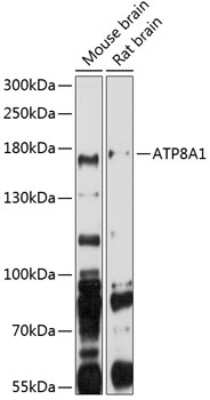 Western Blot: ATP8A1 Antibody [NBP2-92425] - Analysis of extracts of various cell lines, using ATP8A1 at 1:1000 dilution.Secondary antibody: HRP Goat Anti-Rabbit IgG (H+L) at 1:10000 dilution.Lysates/proteins: 25ug per lane.Blocking buffer: 3% nonfat dry milk in TBST.Detection: ECL Basic Kit .Exposure time: 90s.