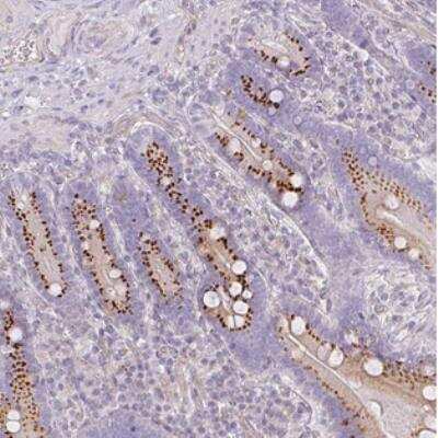 Immunohistochemistry ATP8B2 Antibody